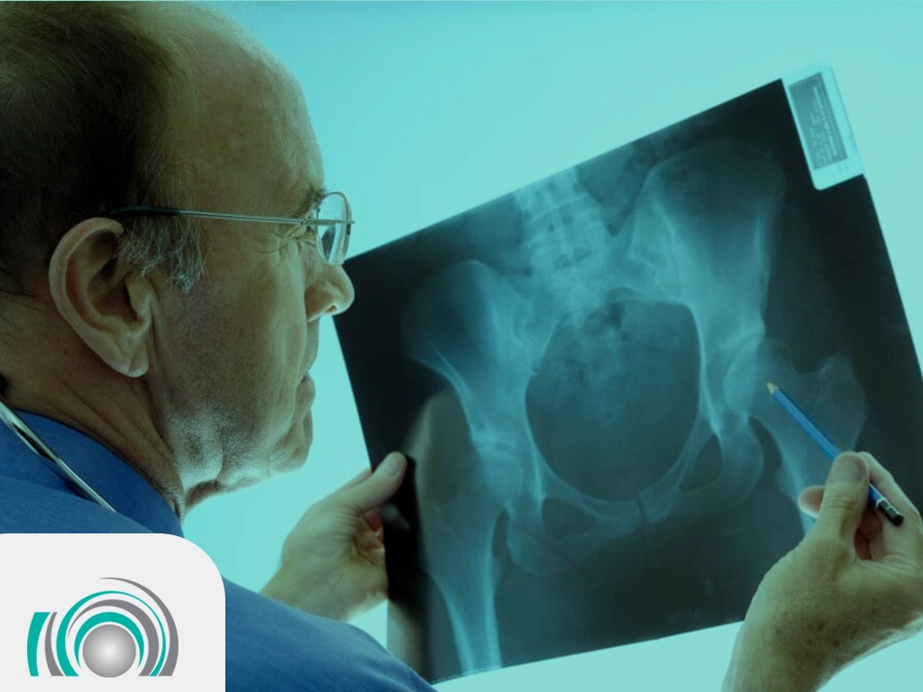 سنجش تراکم استخوان